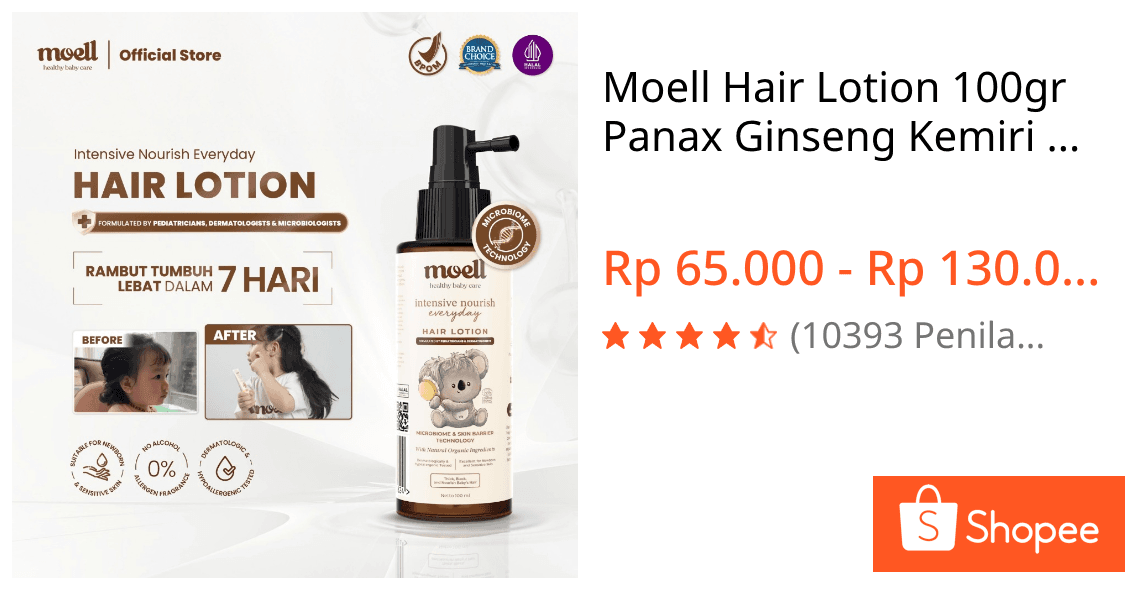 Review Moell Hair Lotion: Bikin Rambut Bayi Lebat?